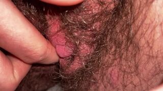 my swollen clit after hours of edging